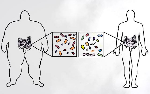 microbiota intestinale-obesità